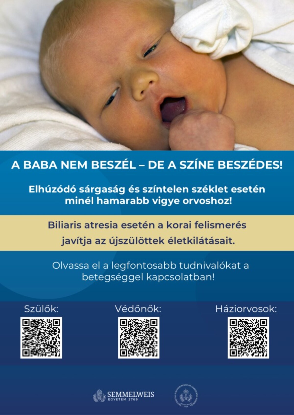 sárgaságbaba